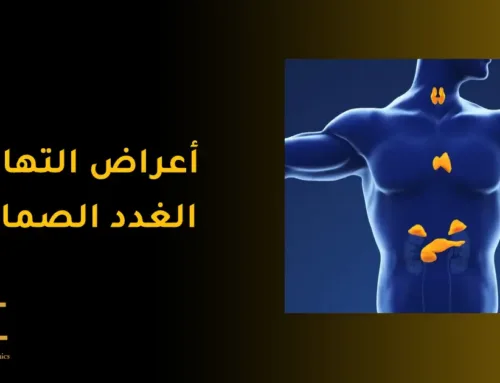 ماهي اعراض التهاب الغدد الصماء؟