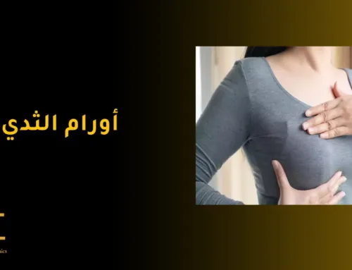 أورام الثدي .. الأعراض والأسباب وطرق العلاج