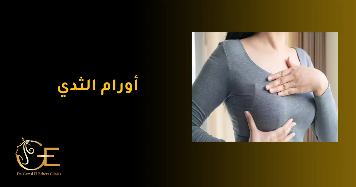 أورام الثدي
