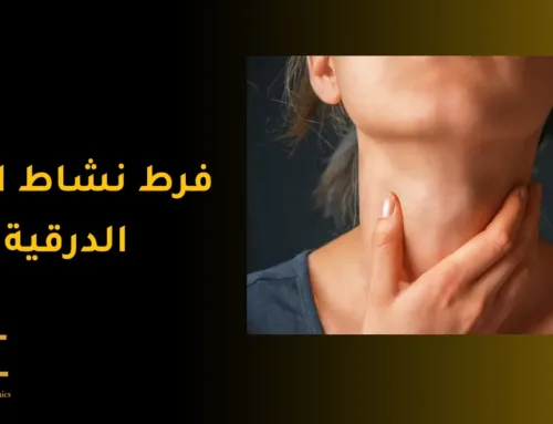 فرط نشاط الغدة الدرقية: الأعراض، الأسباب والعلاج