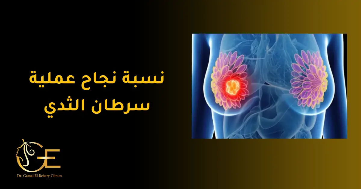 نسبة نجاح عملية سرطان الثدي