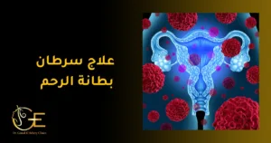 علاج سرطان بطانة الرحم