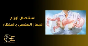 استئصال أورام الجهاز الهضمي بالمنظار استئصال أورام الجهاز الهضمي بالمنظار